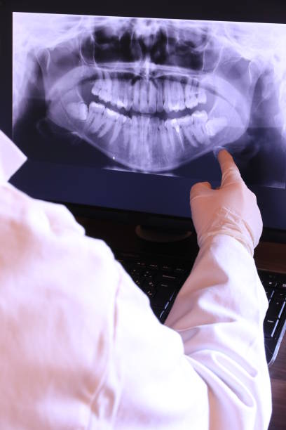 Teeth Whitening in IA